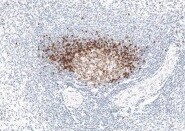 TCL1A Antibody (1-21) - BSA Free NBP1-43253