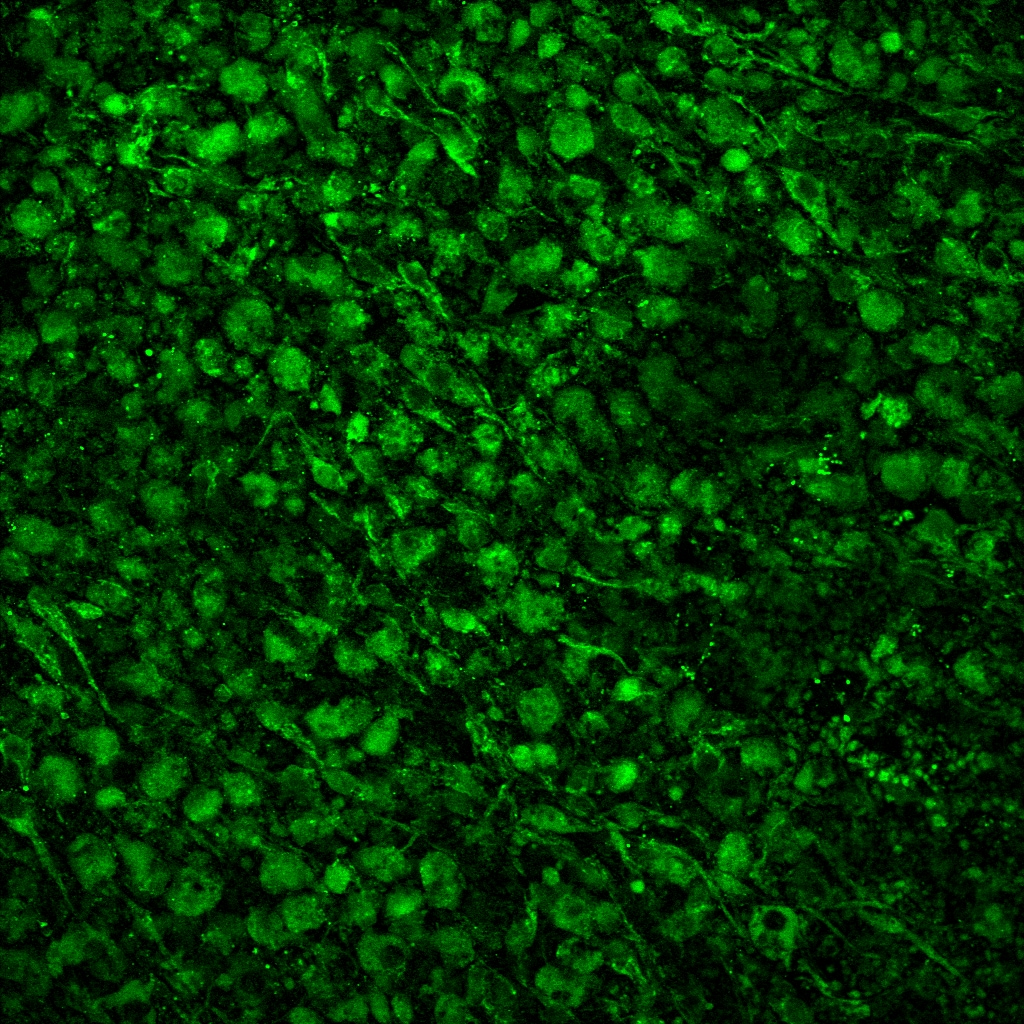 T-bet/TBX21 Antibody (39D) - BSA Free NBP1-43299