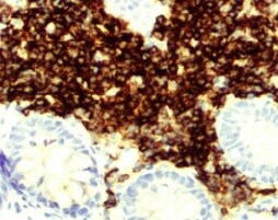 CD23/Fc epsilon RII Antibody (EBVCS2) - BSA Free NBP1-43433