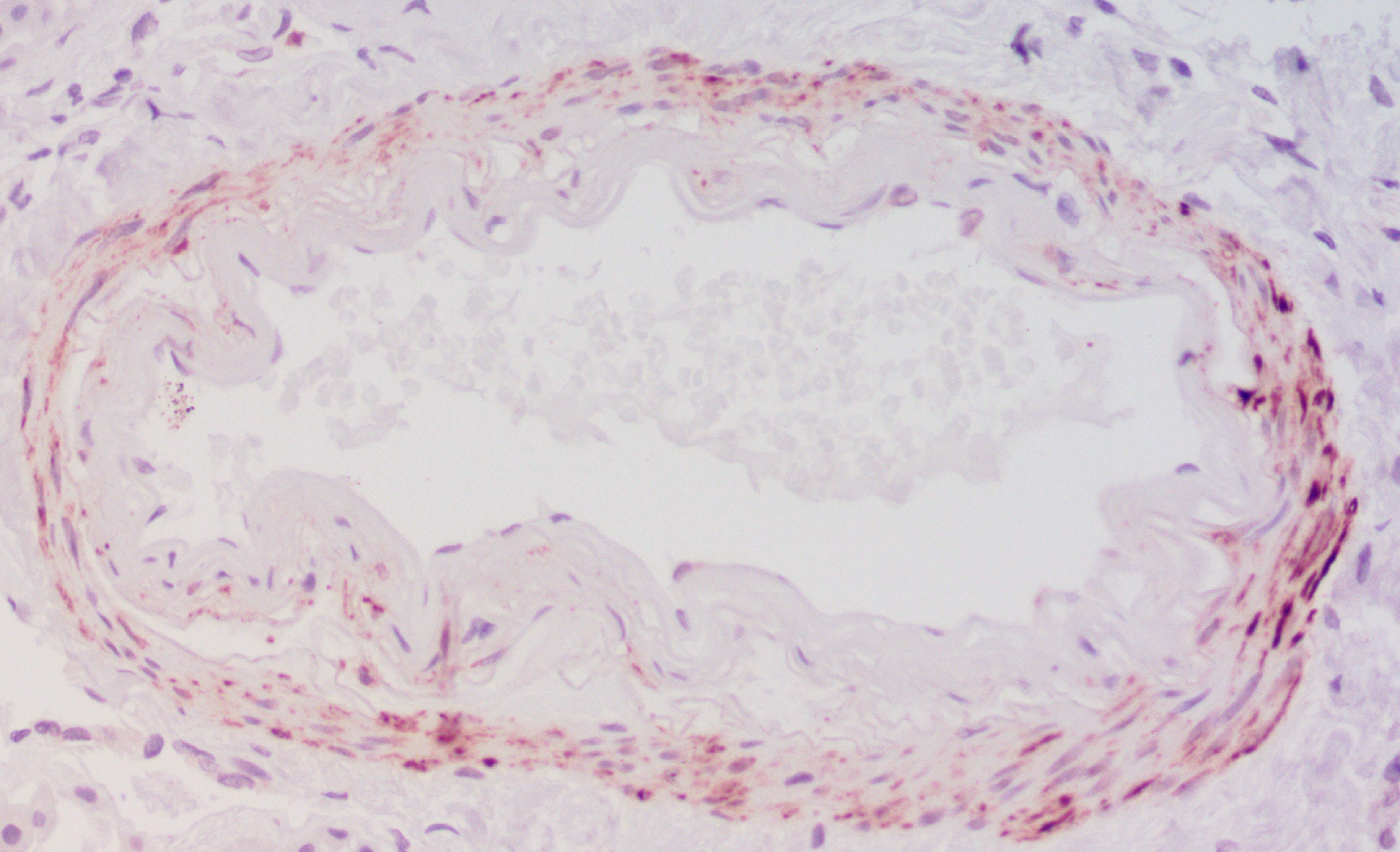Desmin Antibody - C-terminus NBP1-45143