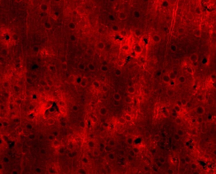BDNF Antibody NBP1-46750