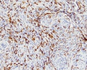 Integrin beta 2/CD18 Antibody (10E12) NBP1-47440