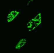 MuSK Antibody (10A4) NBP1-47441