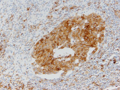 VCAM-1/CD106 Antibody (6G9) - BSA Free NBP1-47491