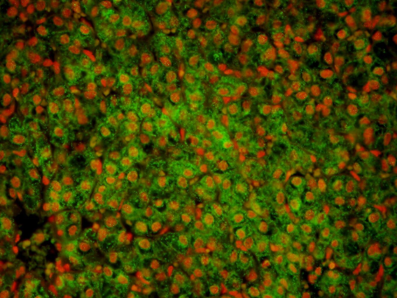GATA-1 Antibody (4F5) NBP1-47492