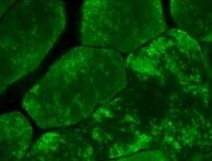 AlphaB Crystallin/CRYAB Antibody (OTI6A9) NBP1-47708