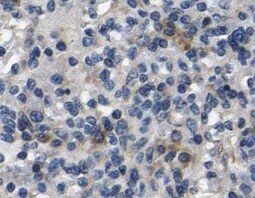 MKK4/MEK4 Antibody (OTI8A8) NBP1-47839