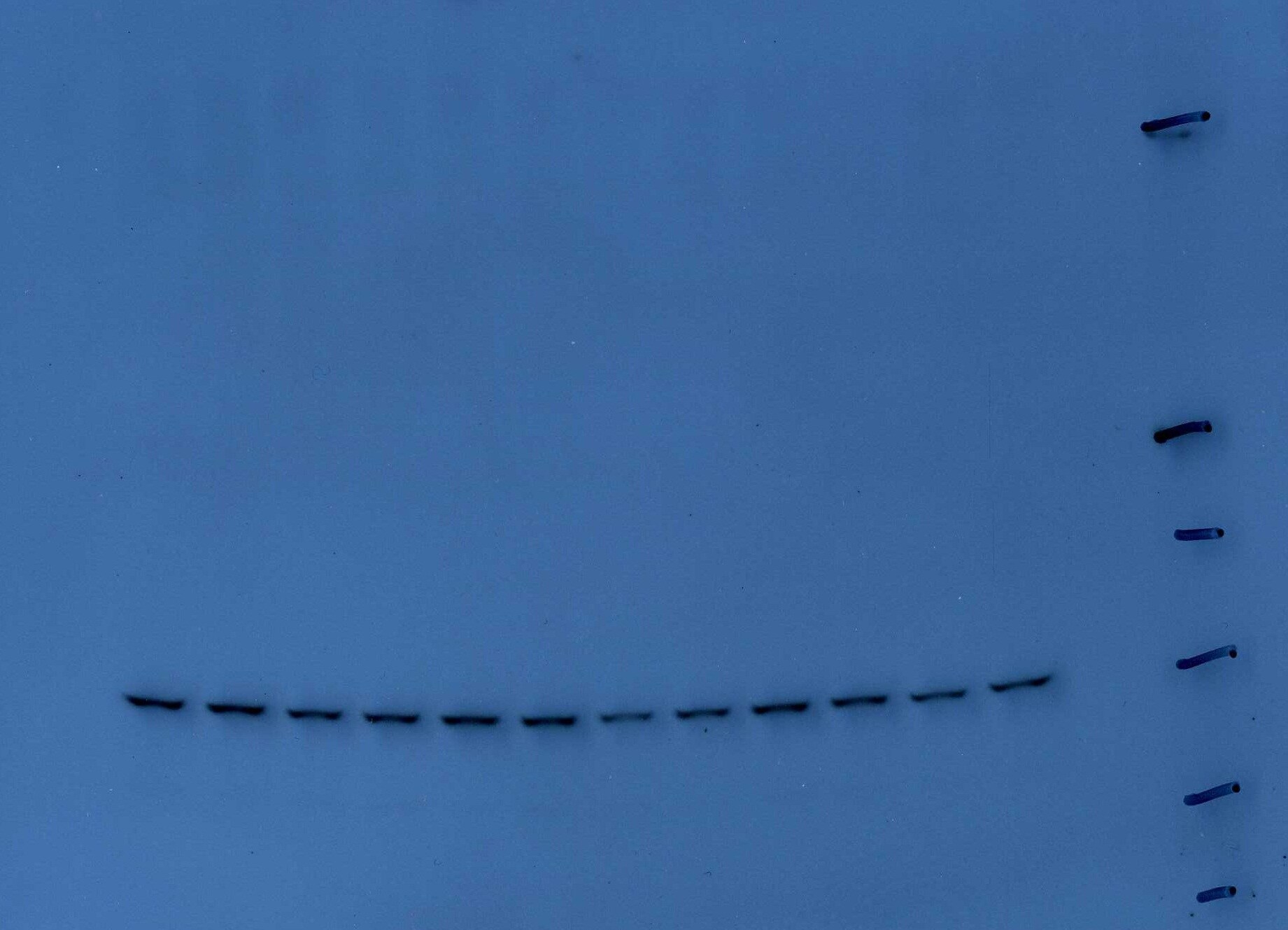 Protein Kinase A regulatory subunit I alpha Antibody (OTI6C7) NBP1-47935