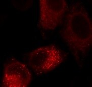 PMEL17/SILV Antibody (OTI10E5) NBP1-47974