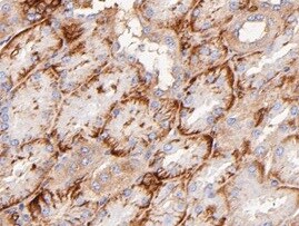Glut5 Antibody (OTI9F3) NBP1-47980