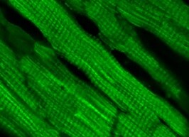TRPM4 Antibody (OTI10H5) NBP1-48036