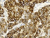 TRPM4 Antibody (OTI10H5) NBP1-48036