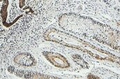 Cytokeratin 8 Antibody (OTI1B12) NBP1-48281
