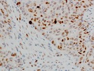PLK1 Antibody (OTI1D4) NBP1-48291