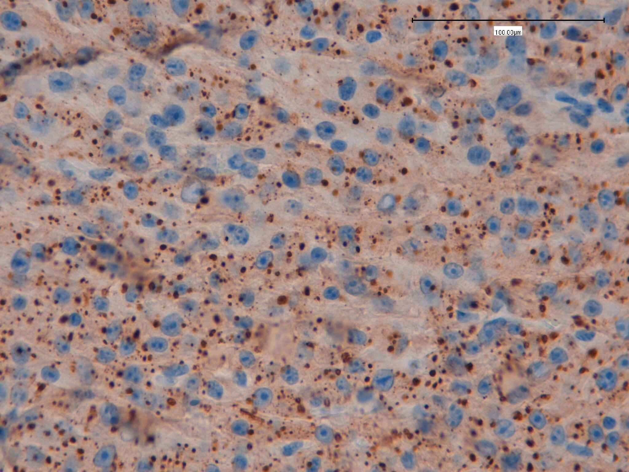 p62/SQSTM1 Antibody - BSA Free NBP1-48320