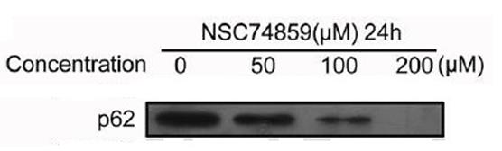 p62/SQSTM1 Antibody - BSA Free NBP1-48320