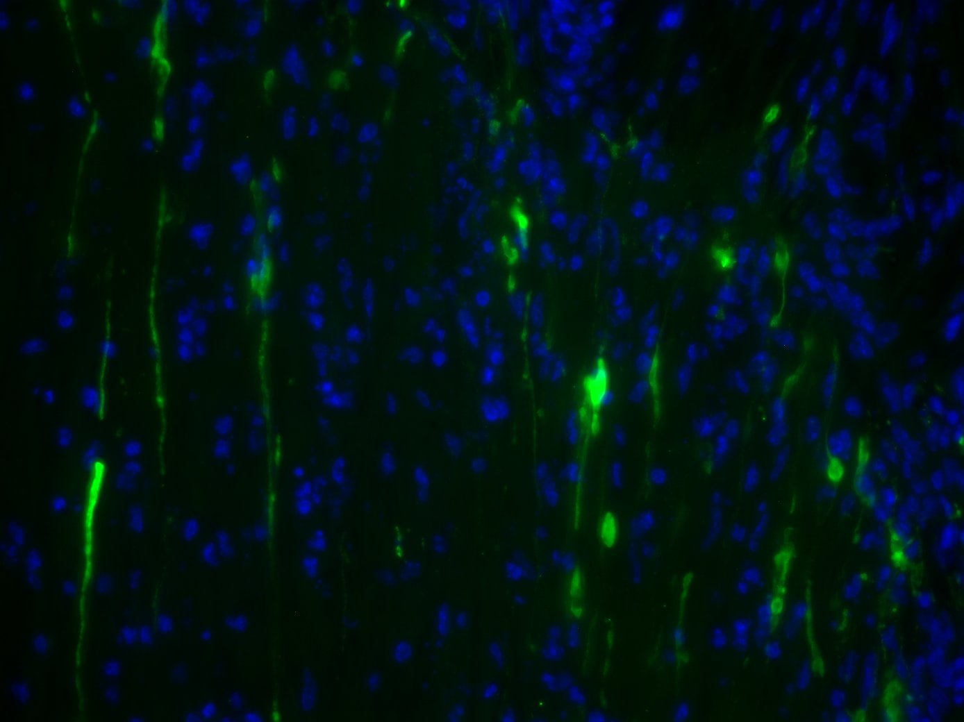 Stathmin-2/STMN2 Antibody - BSA Free NBP1-49461