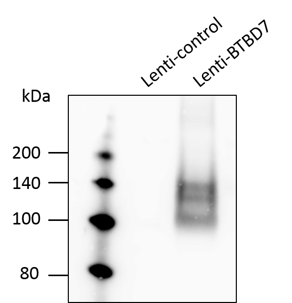 BTBD7 Antibody NBP1-49652