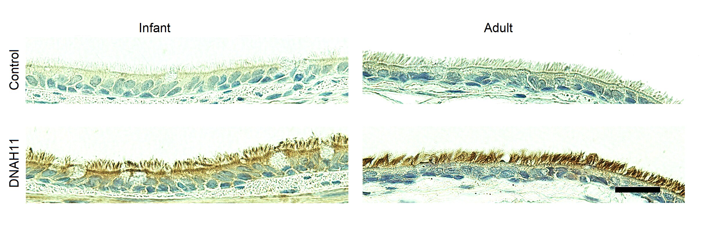 DNAH11 Antibody NBP1-49883