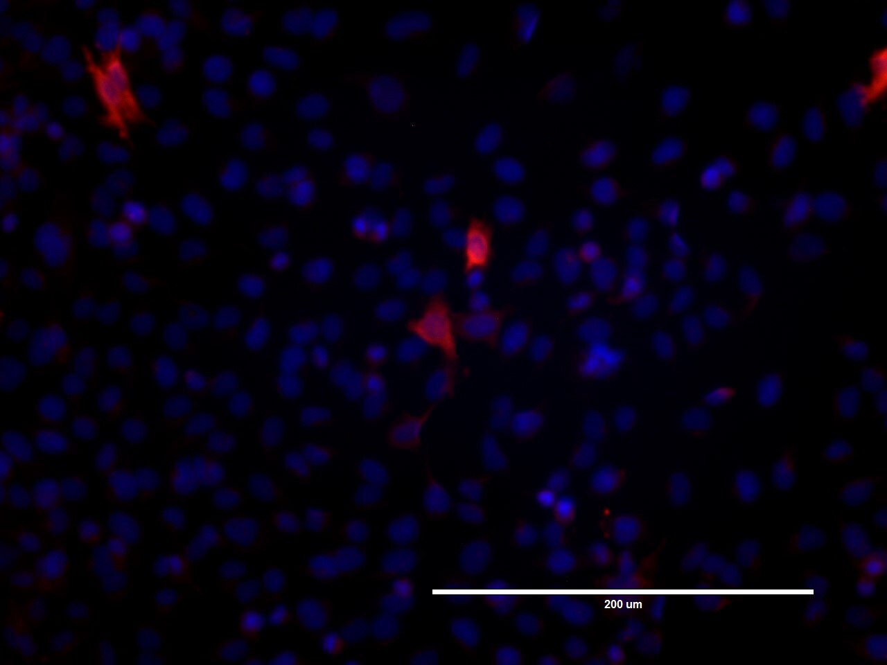 Gigaxonin Antibody - BSA Free NBP1-49924