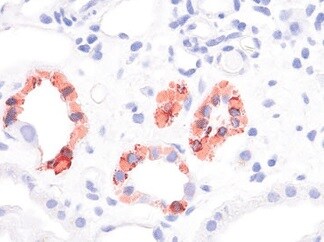 Uromodulin Antibody (10.32) - BSA Free NBP1-50321
