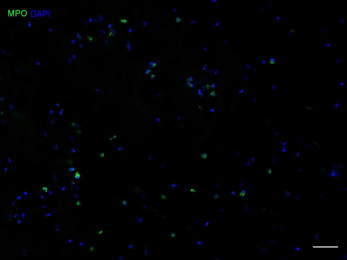 Myeloperoxidase/MPO Antibody (8F4) NBP1-51148