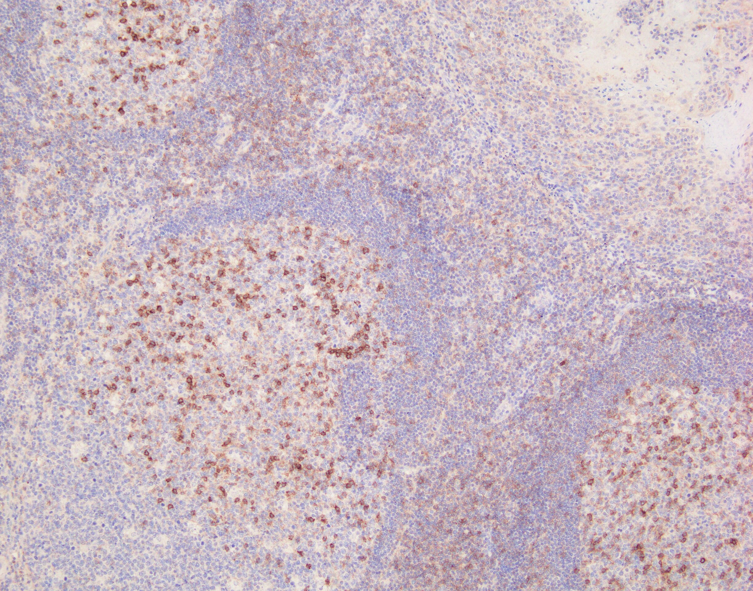 CD69 Antibody (8B6) NBP1-51607