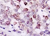 Rictor Antibody (7B3) - BSA Free NBP1-51645