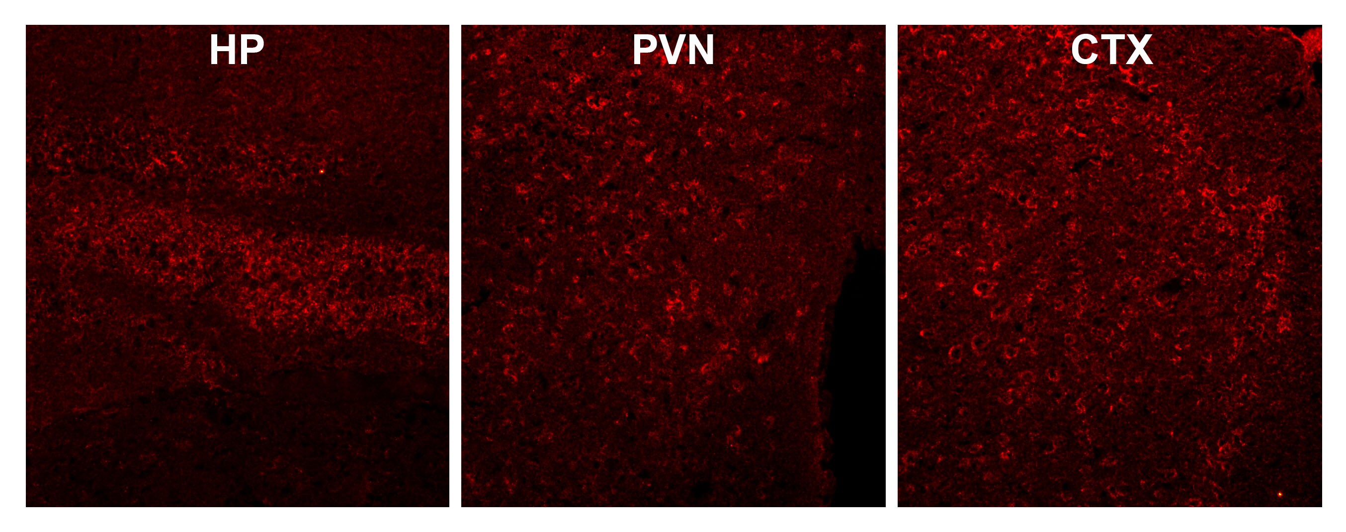 CaM Kinase II alpha Antibody NBP1-51945