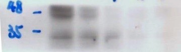 MURF3 Antibody - BSA Free NBP1-52899