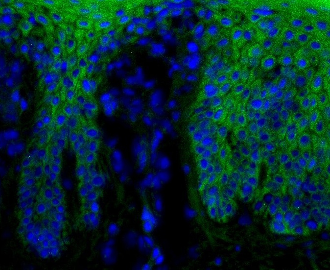 beta-Catenin Antibody (12F7) [FITC] NBP1-54467F