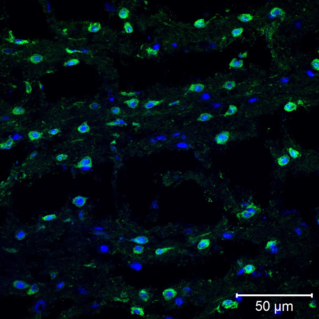 TXNIP Antibody (JY2) - Azide and BSA Free NBP1-54578