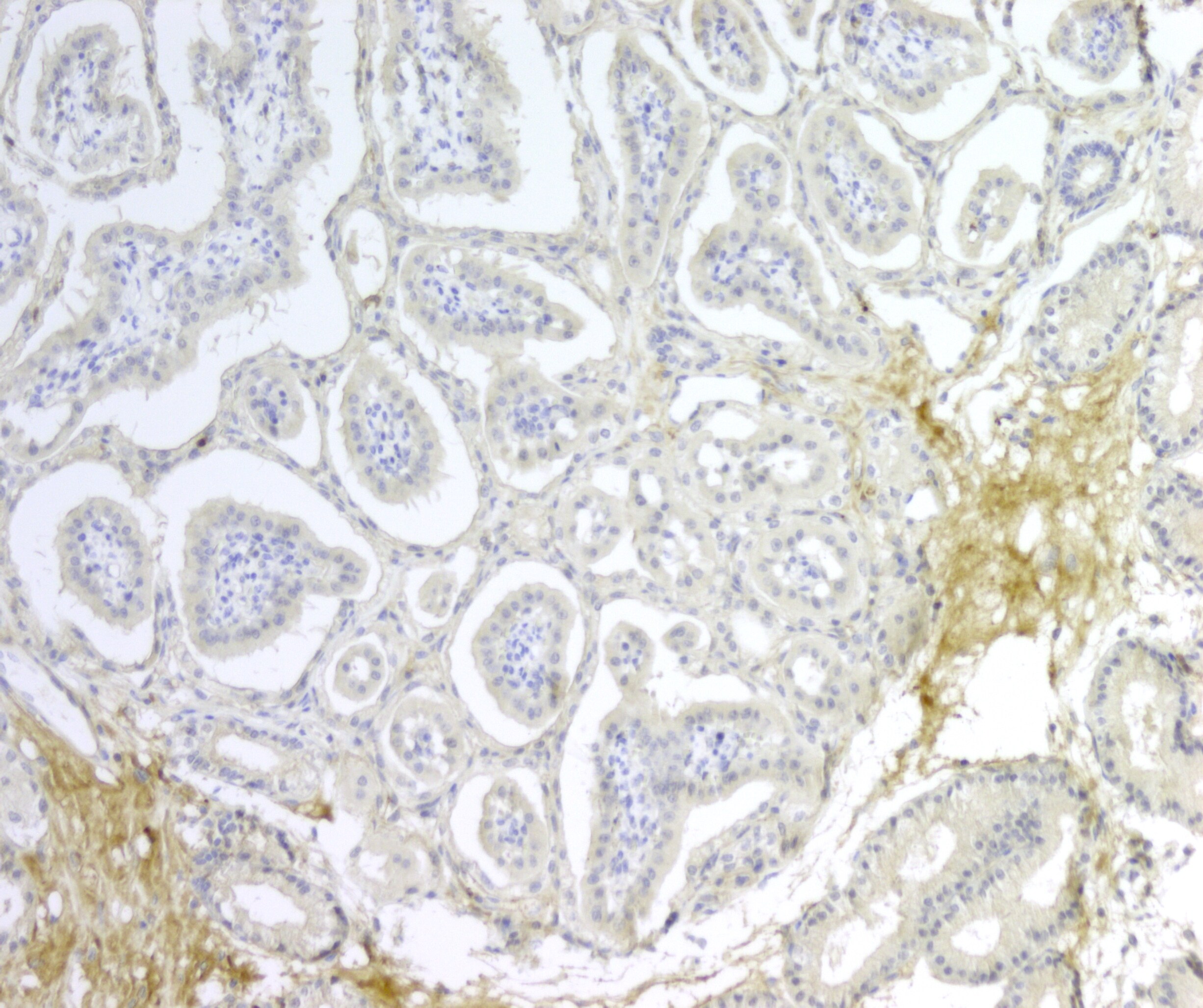 Prothrombin Antibody - BSA Free NBP1-58268