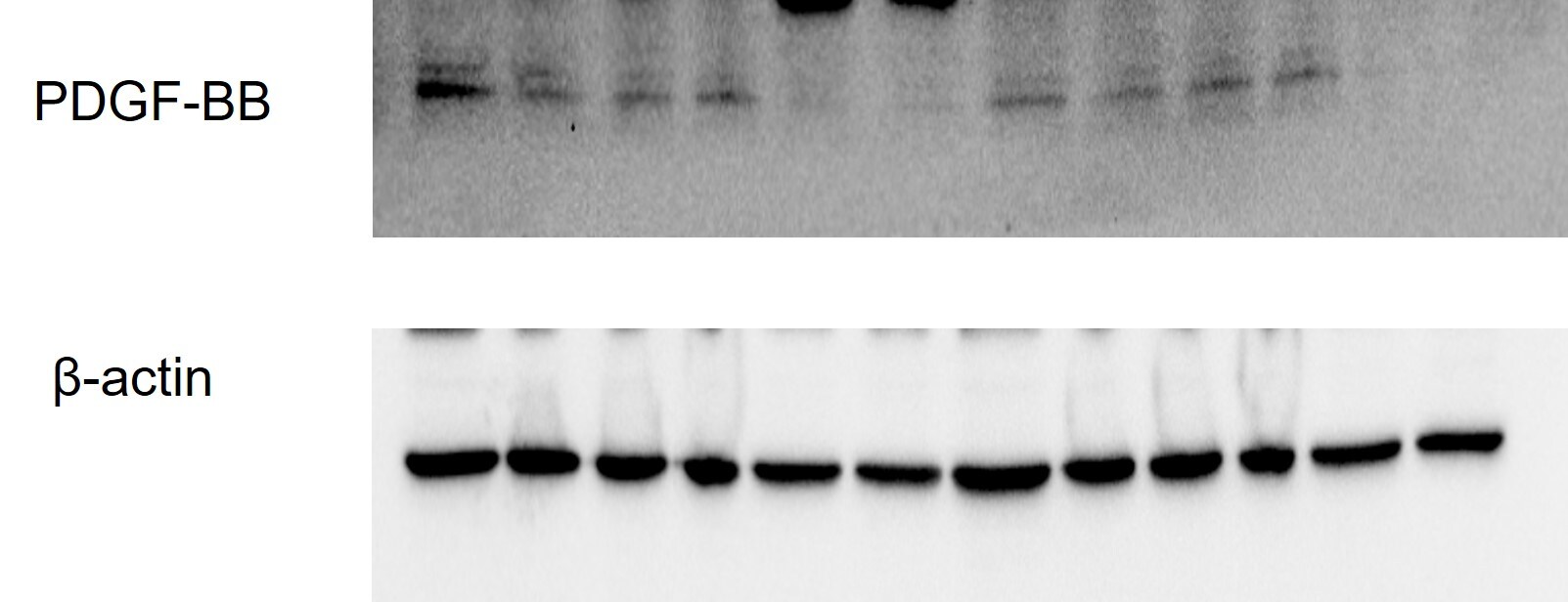 PDGF-B Antibody - BSA Free NBP1-58279