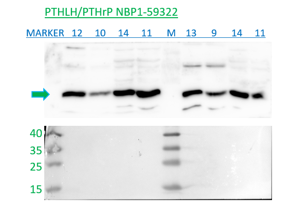 PTHLH/PTHrP Antibody - BSA Free NBP1-59322