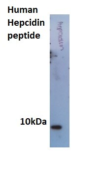 Hepcidin Antimicrobial Peptide Antibody - BSA Free NBP1-59337