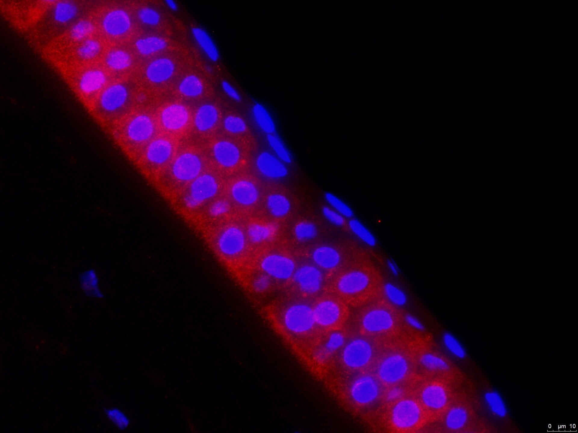 Hepcidin Antimicrobial Peptide Antibody - BSA Free NBP1-59337