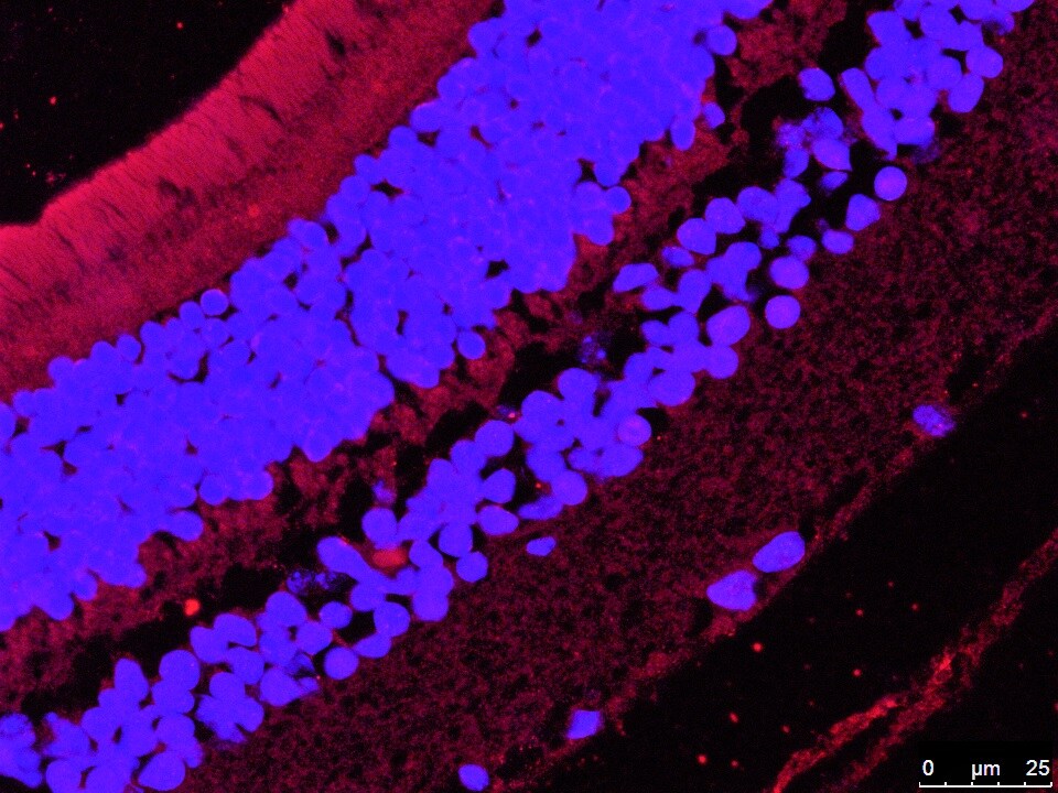 Hepcidin Antimicrobial Peptide Antibody - BSA Free NBP1-59337