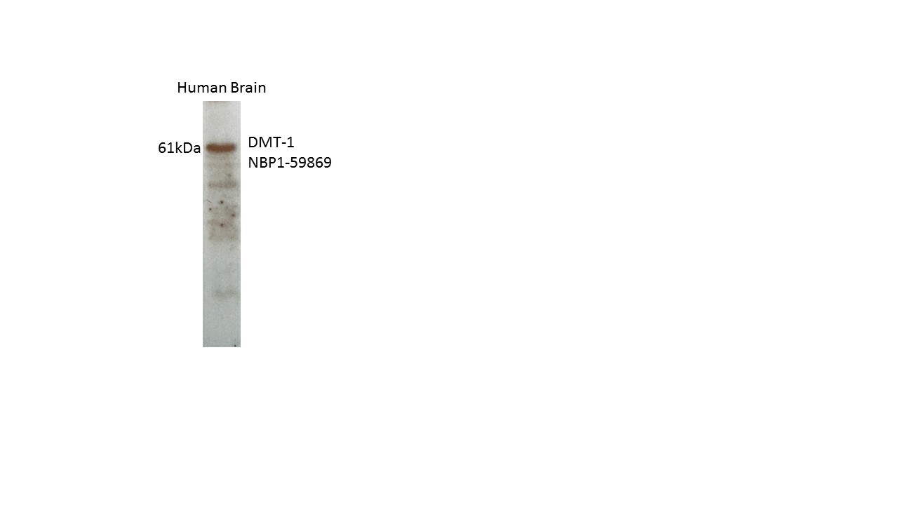 NRAMP2/SLC11A2/DMT1 Antibody - BSA Free NBP1-59869