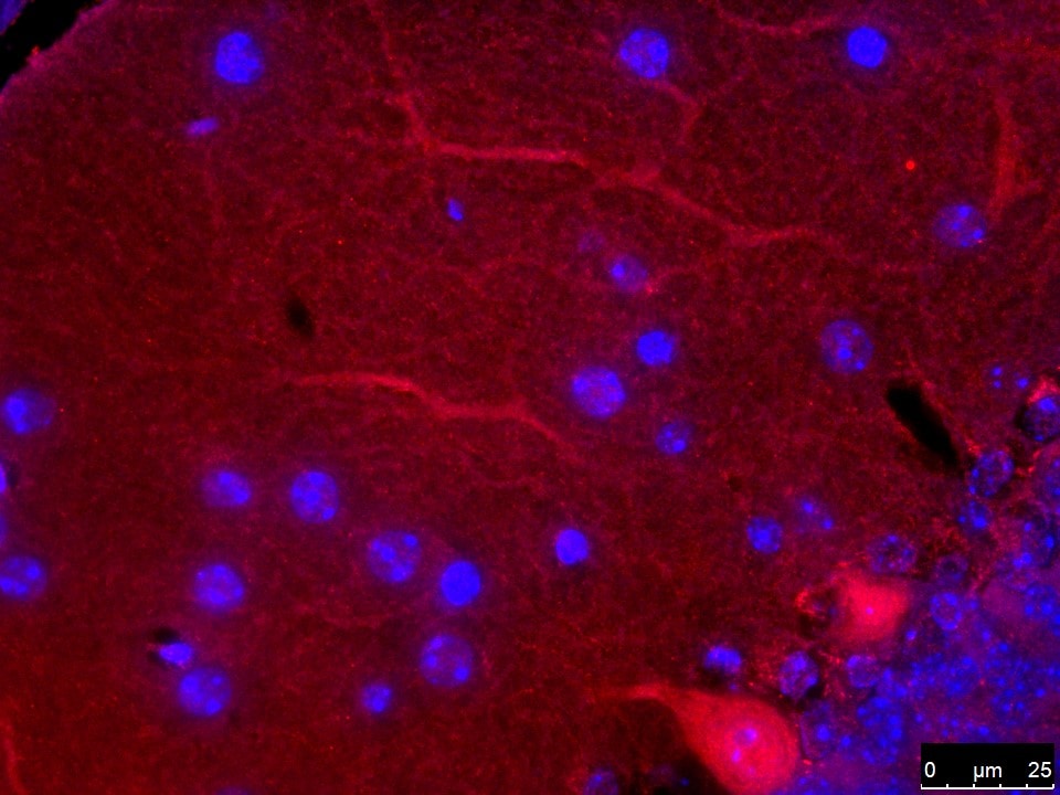 NRAMP2/SLC11A2/DMT1 Antibody - BSA Free NBP1-59869