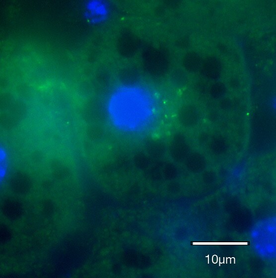 ASGPR1 Antibody (8D7) NBP1-60150