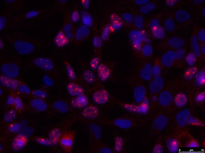 IGHMBP2 Antibody - BSA Free NBP1-68921