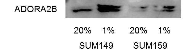Adenosine A2b R Antibody - BSA Free NBP1-68953