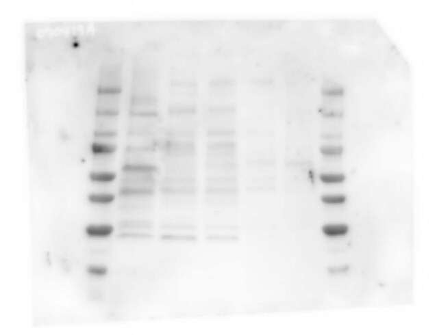 Nicotinic Acetylcholine R alpha 5/CHRNA5 Antibody - BSA Free NBP1-69122