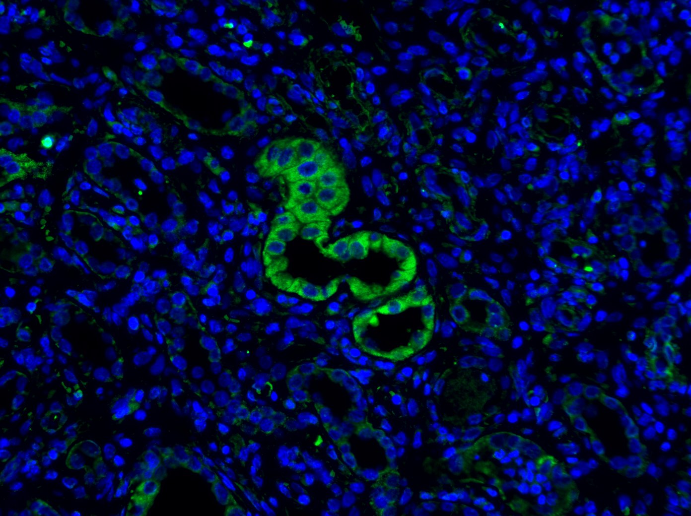 Aquaporin-2 Antibody NBP1-70378