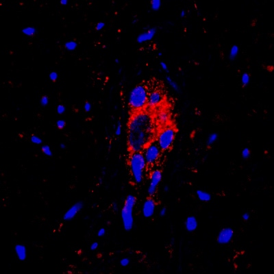 Vanilloid R1/TRPV1 Antibody - BSA Free NBP1-71774