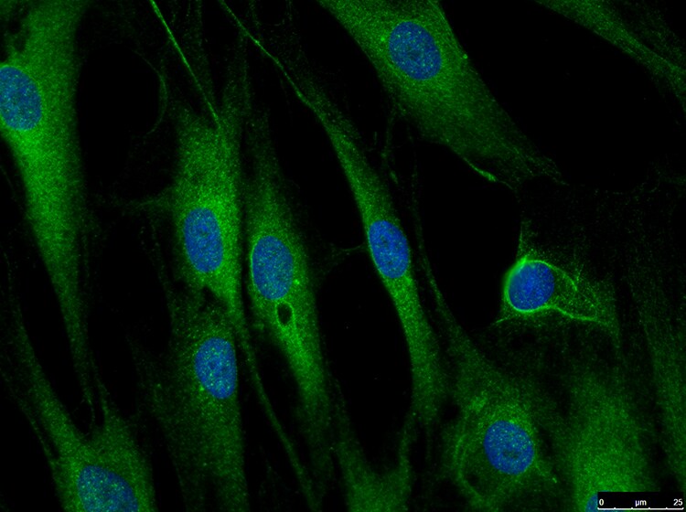LRRFIP1 Antibody NBP1-71835