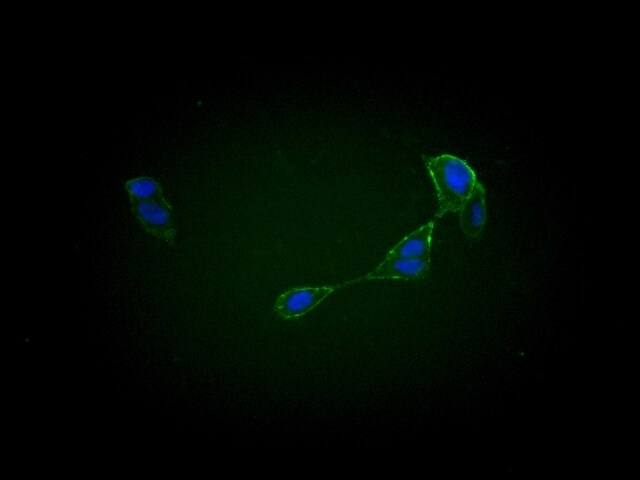 Goat anti-Human IgG (H+L) Secondary Antibody [DyLight 488] (Pre-adsorbed) NBP1-72861