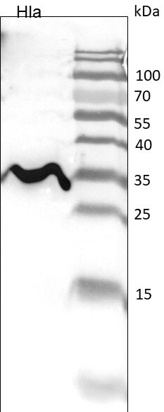 Donkey anti-Rabbit IgG (H+L) Secondary Antibody [HRP] (Pre-adsorbed) NBP1-75290