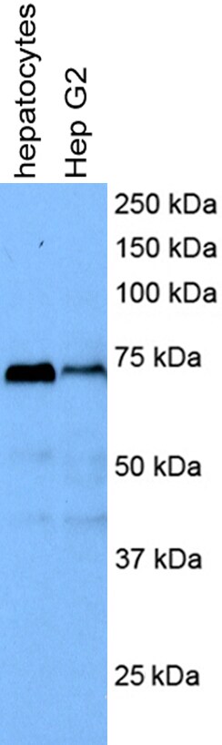 ASAH2/N-acylsphingosine Amidohydrolase-2 Antibody - BSA Free NBP1-76360